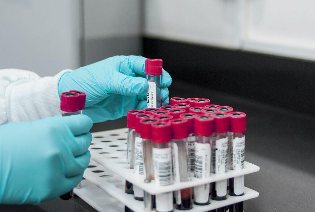 lab, experiment, test